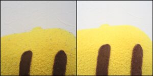 ピカチュウ様ピーリング治療