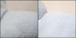 ぞうさんピーリング治療